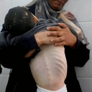 bir yanda katliam bir yanda aclik gazzede can kaybi 61 bin 430 oldu SpjeZT12