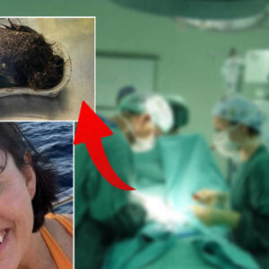 doktorlari bile saskina ceviren olay aylarca karin agrisi ceken 14 yasindaki erinin midesinden inanilmaz bir kitle cikti II42vK1F